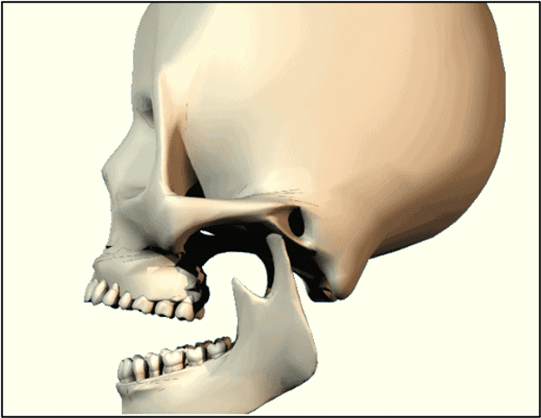 Temporo-mandibular Joint dysfunction